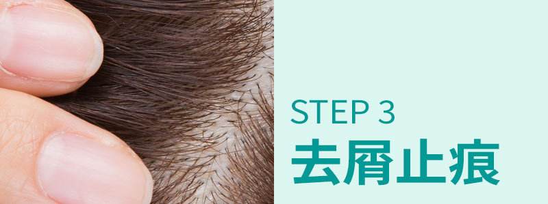 STEP 3 去屑止痕