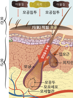 한방에서 본 탈모원인을 도식화한 이미지로 모발 생리 및 탈모 원인의 내용과 동일