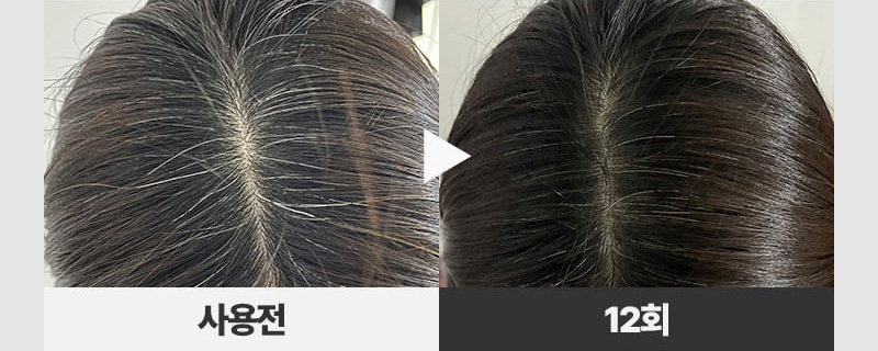 제품상세 내용 아래 참조