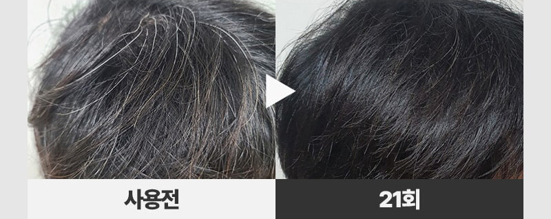 제품상세 내용 아래 참조