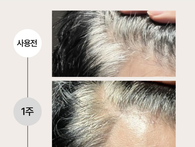 제품상세 내용 아래 참조