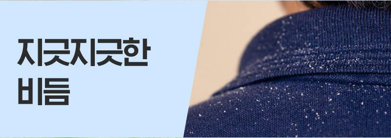 지긋지긋한 비듬