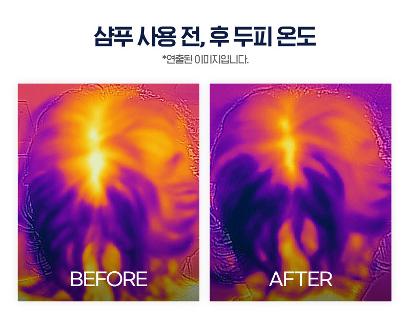 샴푸 사용 전, 후 두피 온도 *연출된 이미지입니다. BEFORE & AFTER
