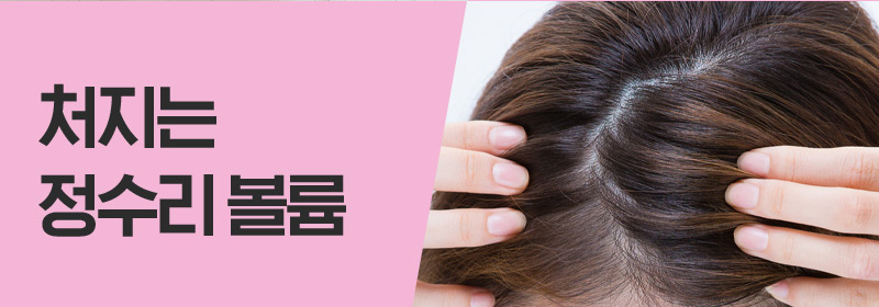 처지는 정수리 볼륨