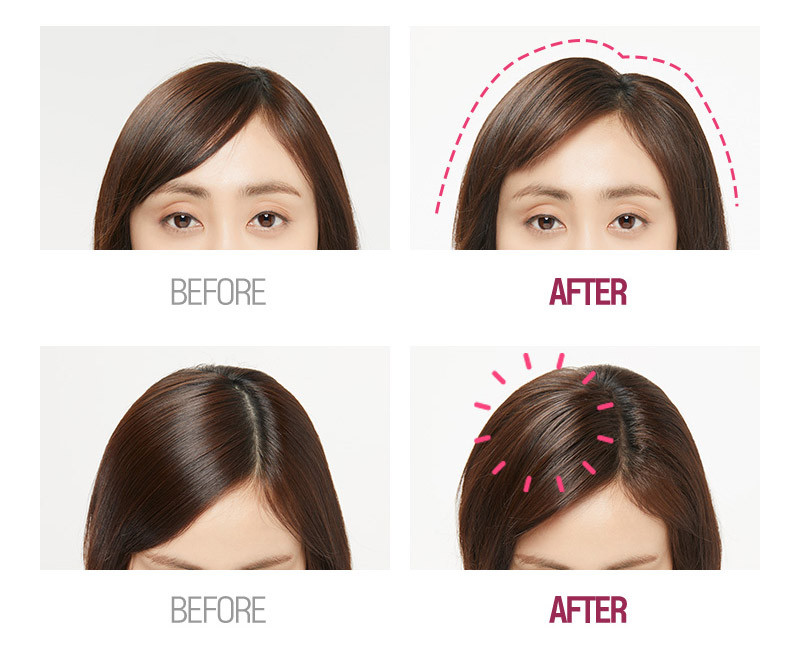 BEFORE & AFTER