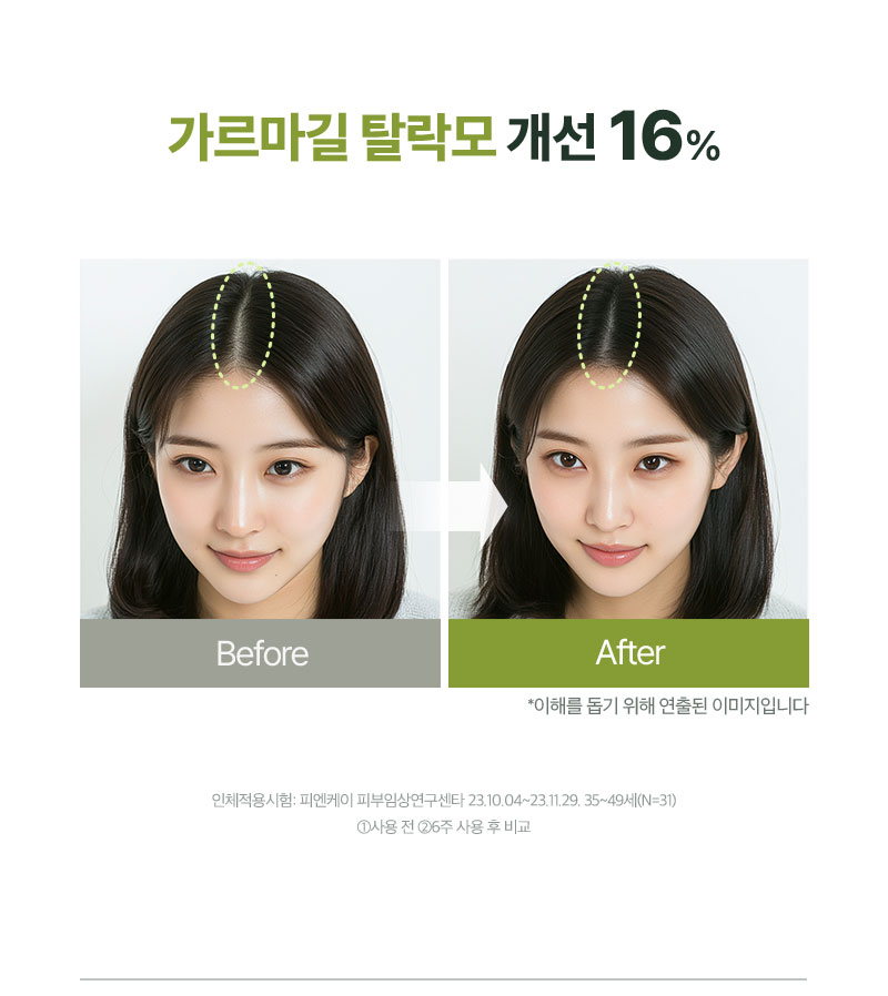 가르마길 탈락모 개선 16%